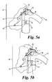US-9999331-B2 fig 5
